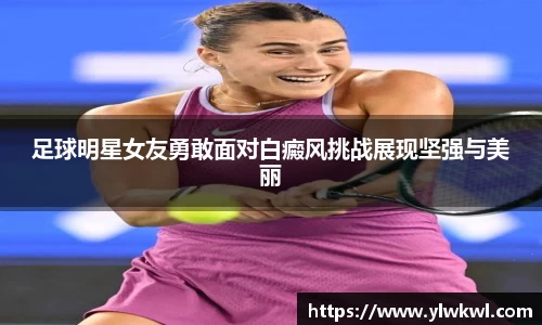 足球明星女友勇敢面对白癜风挑战展现坚强与美丽